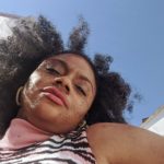 STEP OUT OF YOUR SKIN DISORDER STRESS AND BE BEAUTIFUL